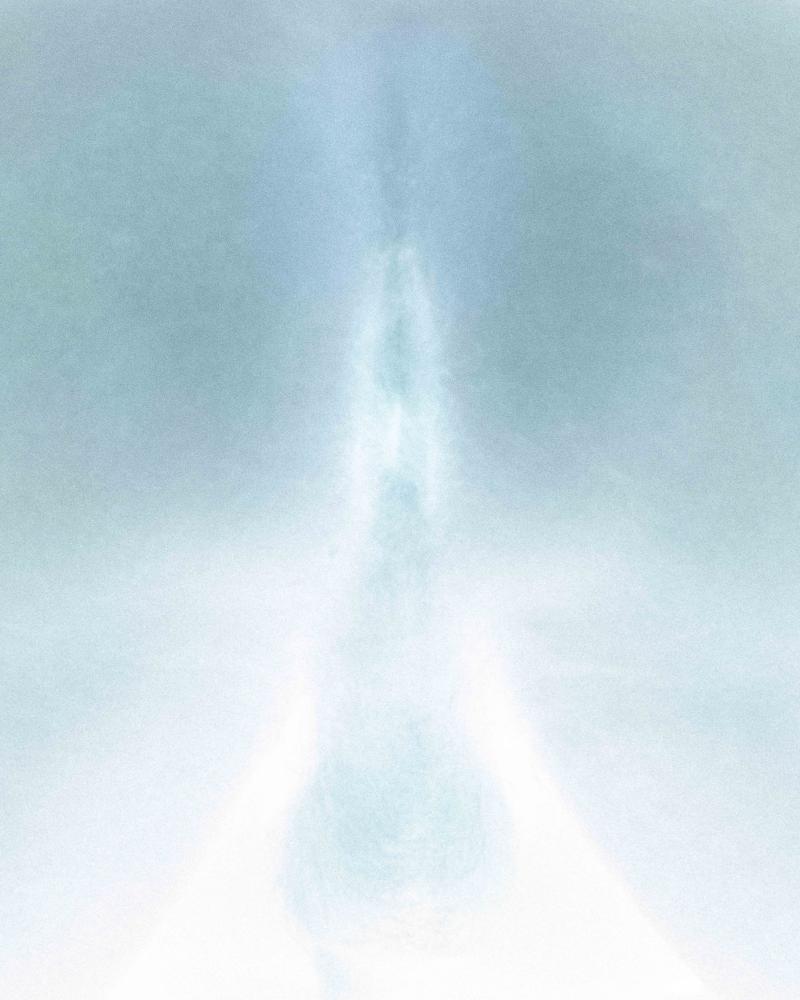 Das Bild zeigt eine abstrakte, weiche Komposition in hellen Blau- und Weißtönen. Gleichzeitig erinnert die zentrale Form an eine anatomische Struktur – insbesondere an einen Anus.