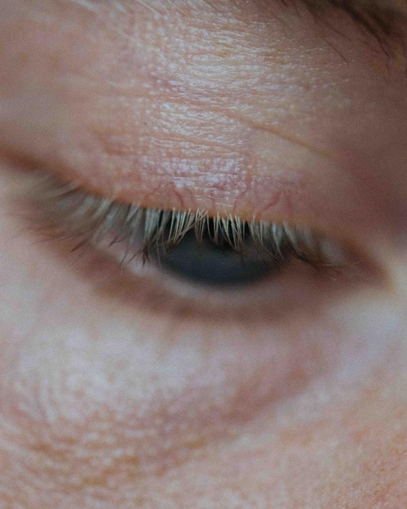 Auge