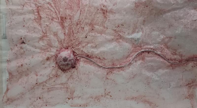 Auf einer rosa-farbenen Fläche ist ein Gerät angebracht, das aussieht wie ein medizinisches Stethoskop. Das Gerät ist so bearbeitet, dass es aussieht wie in die rosa Fläche hineingewachsen. 